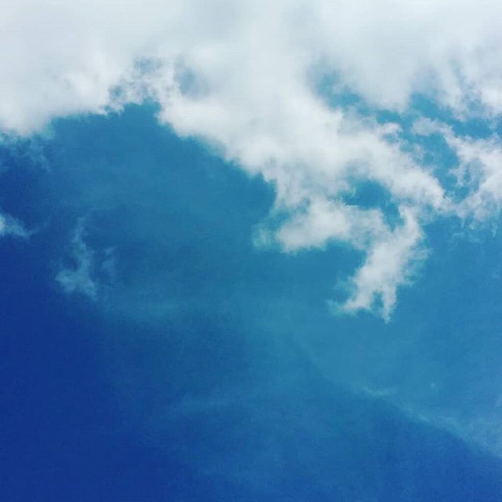 Photo: Cloud watcher Photo: Cloud watcher